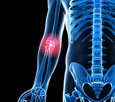 Elbow Pain - treatment