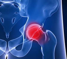 Hip & Knee Pain - treatment