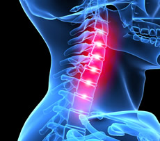 Neck Pain - treatment