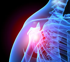 Shoulder Pain - treatment